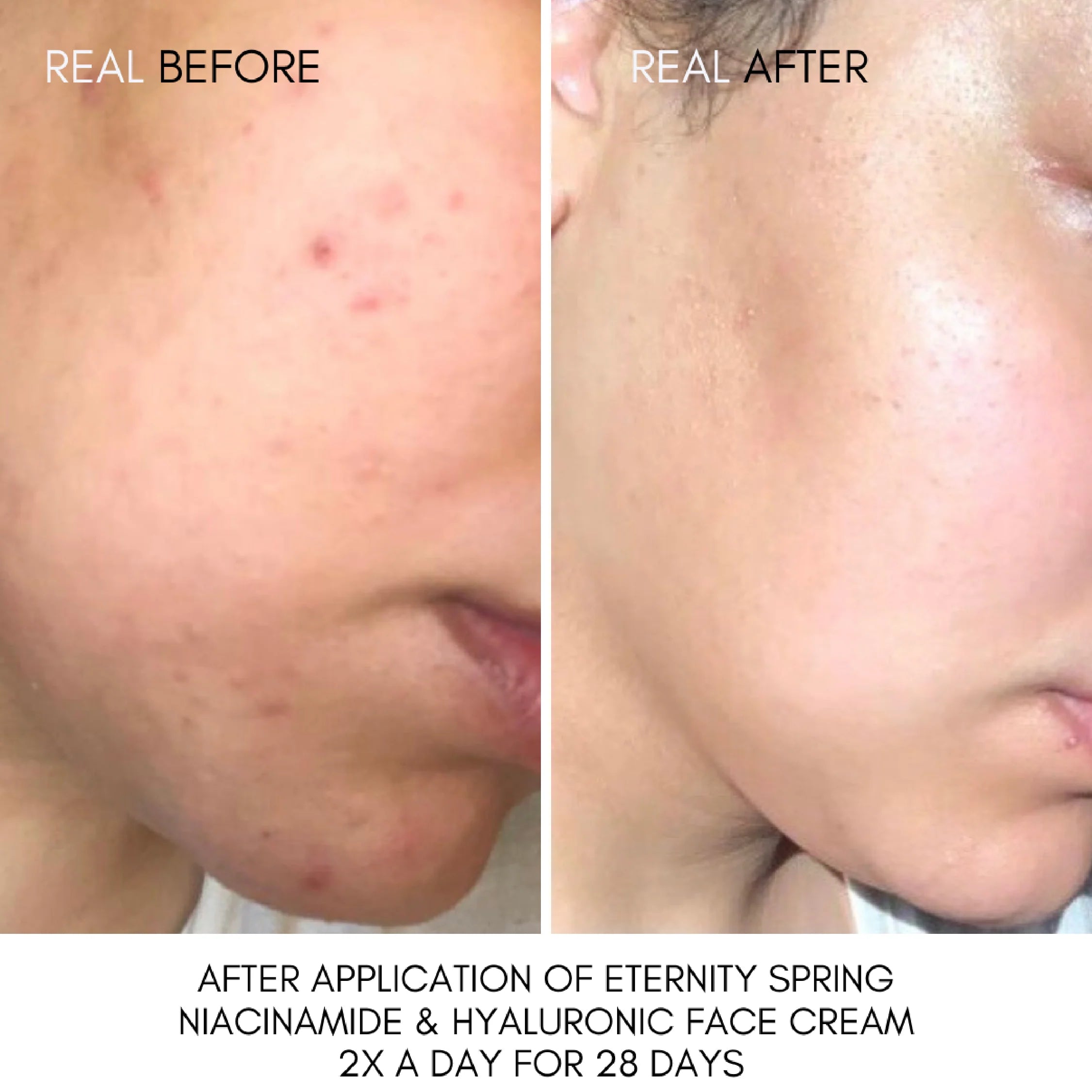 Eternity Spring Niacinamide and Hyaluronic Face Cream