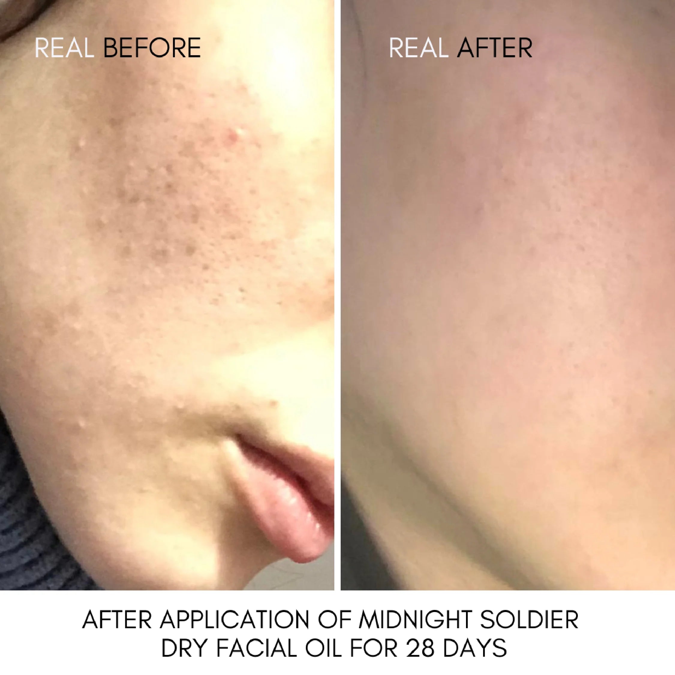Midnight Soldier Rosehip-infused Oil Serum