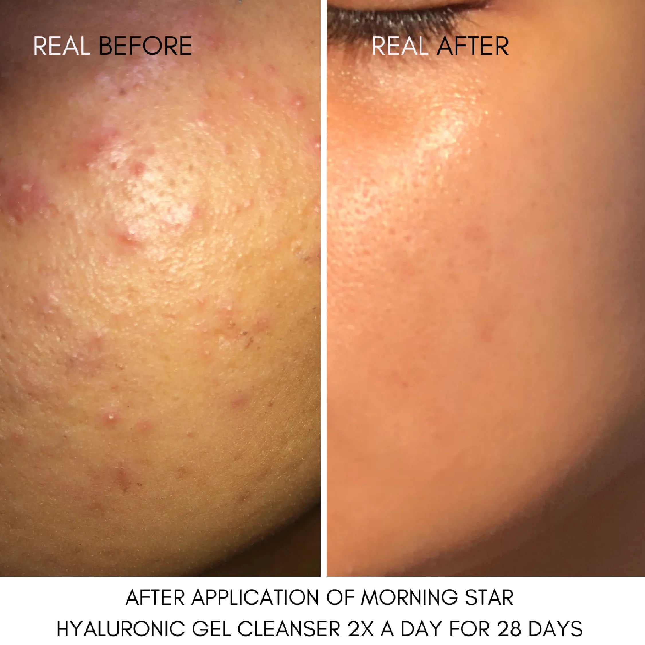 Morning Star Hyaluronic Gel Cleanser