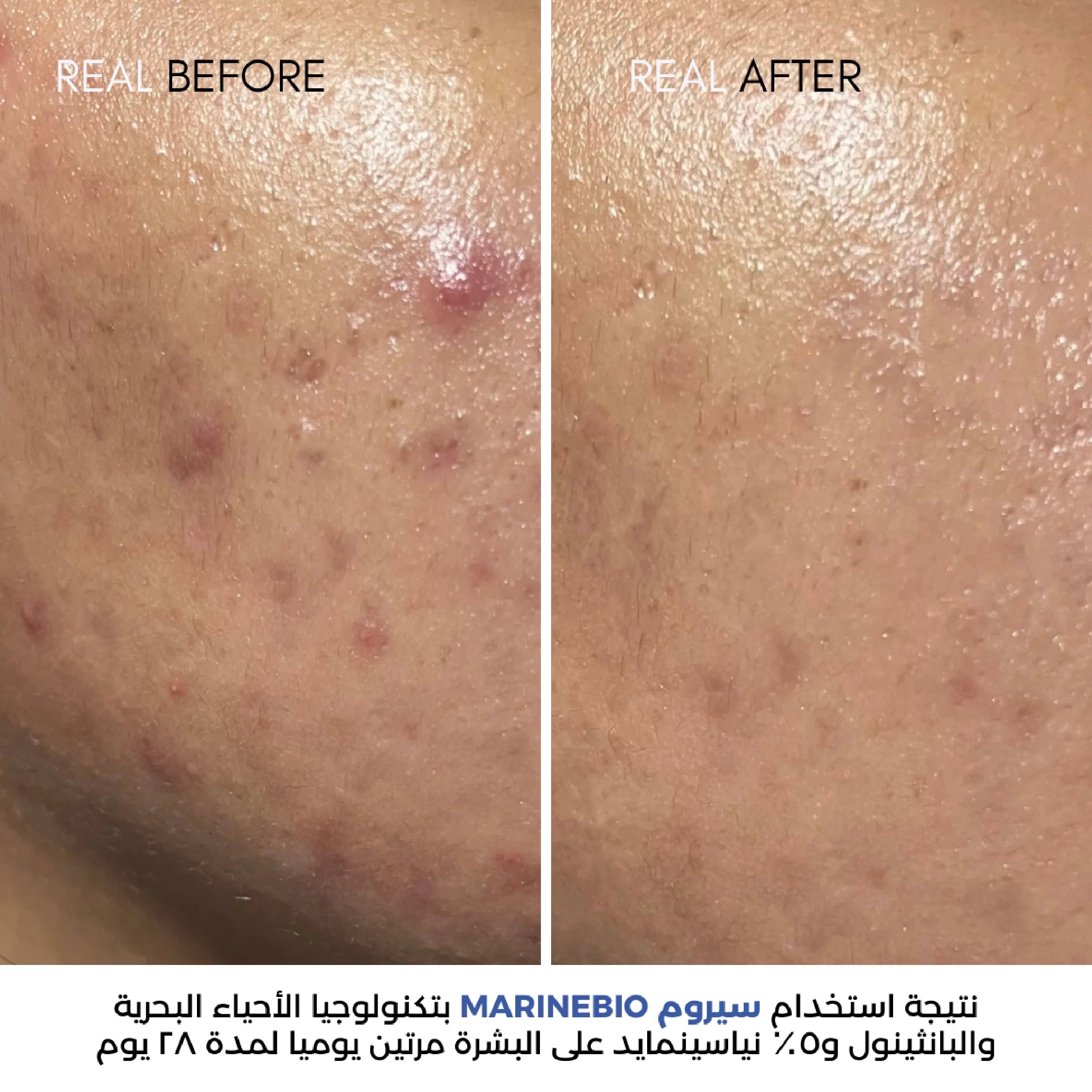 MarineBio 5% Niacinamide Serum