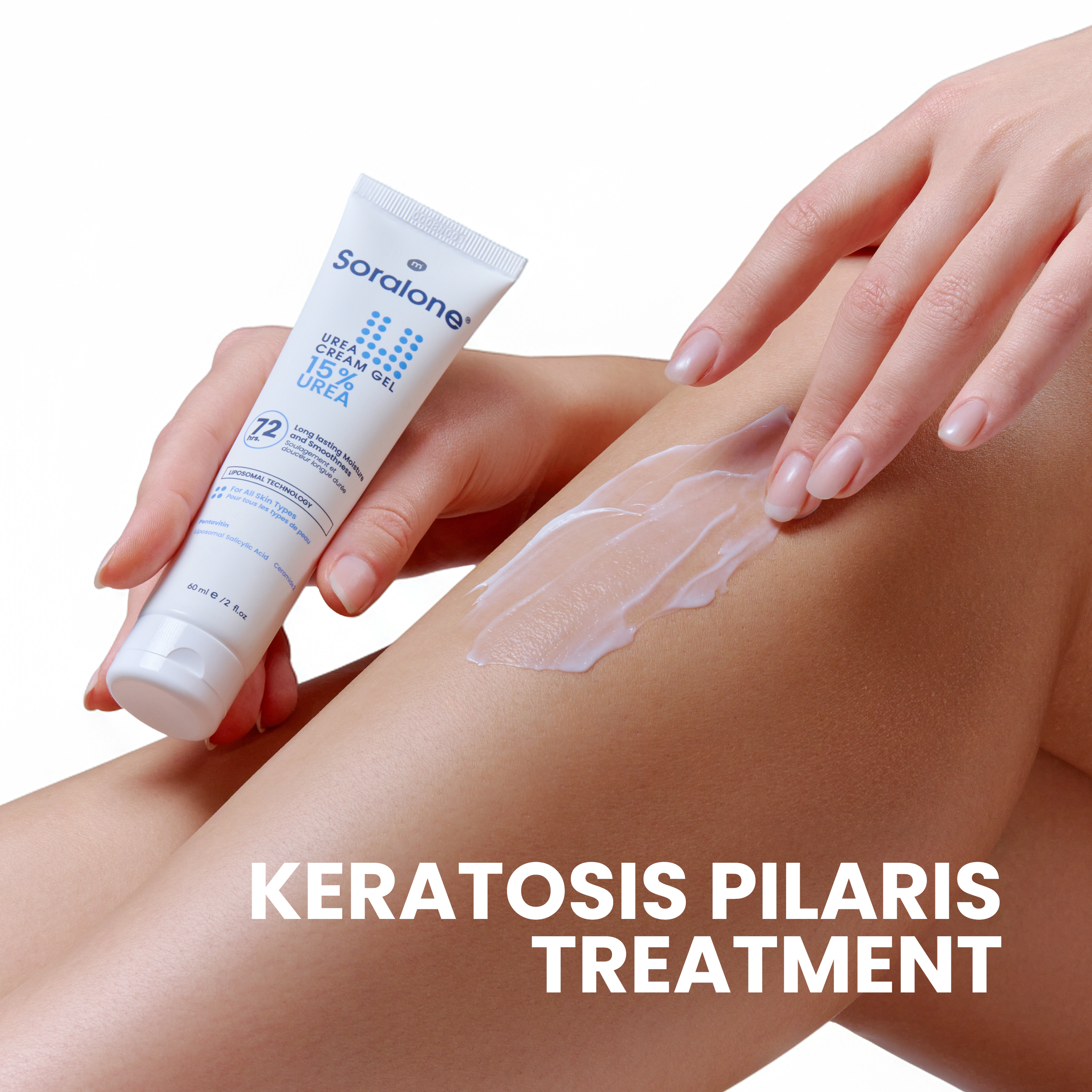 Soralone Urea 15% Cream Gel 60ml